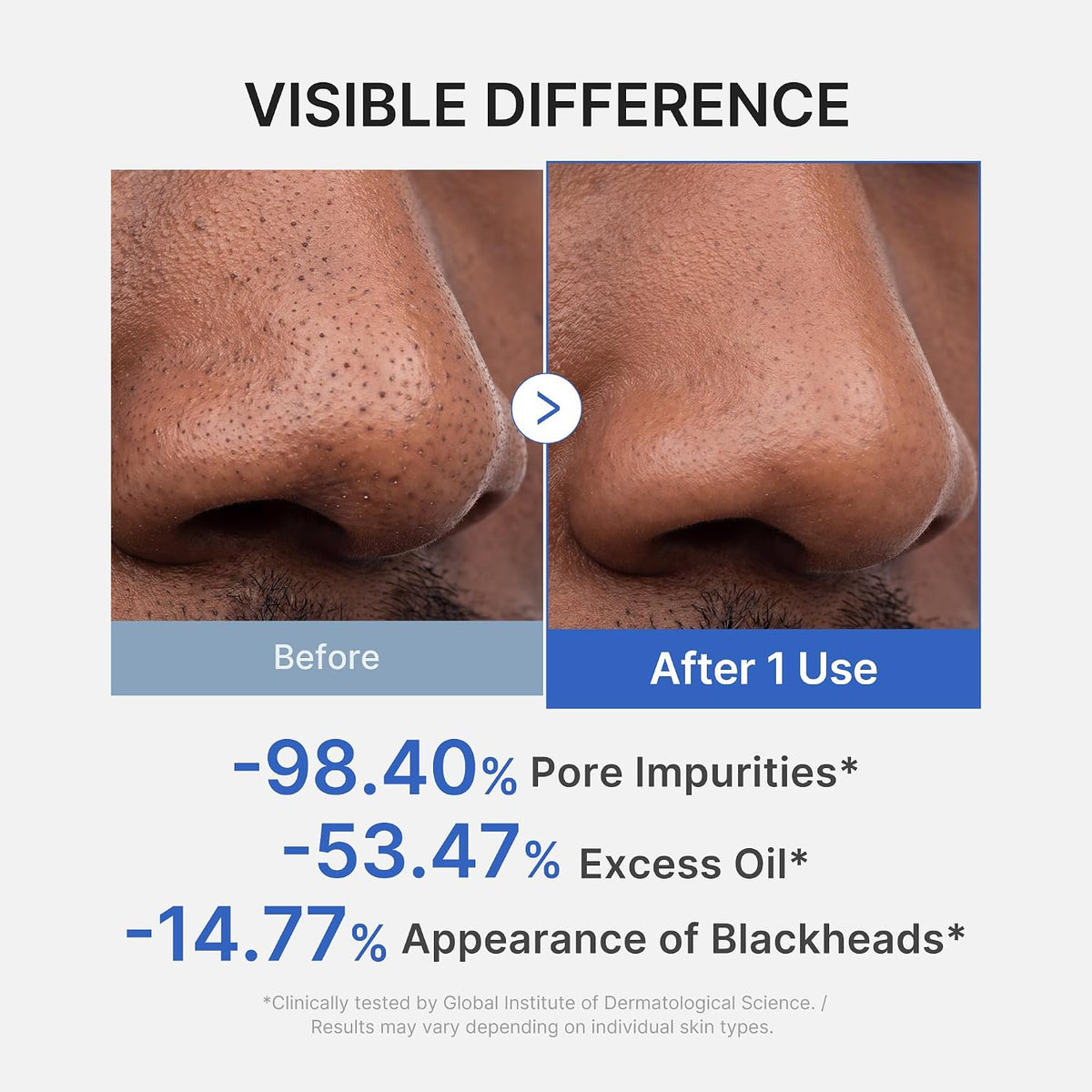 Visible difference after 1 use